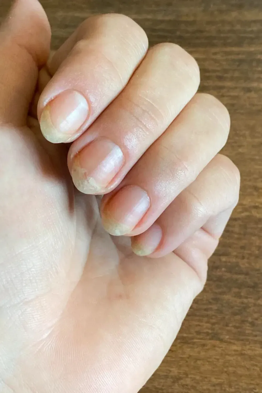 a close-up view of a hand with nails that have a few visible signs of damage