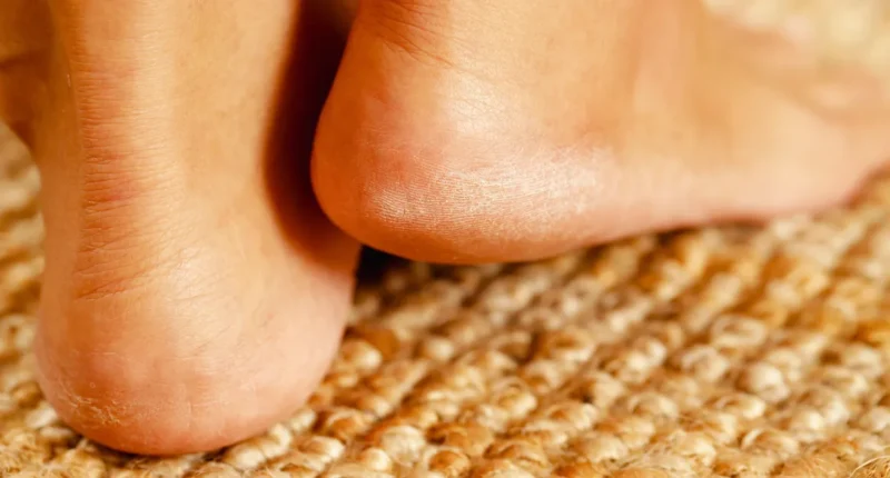 Close-up of a cracked heel being held, emphasizing the need for effective home treatments to remedy dry and cracked foot skin.